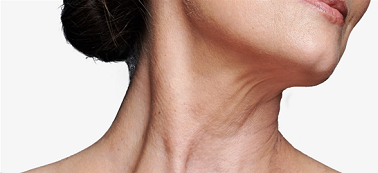Почему кожа шеи теряет упругость? | Блог